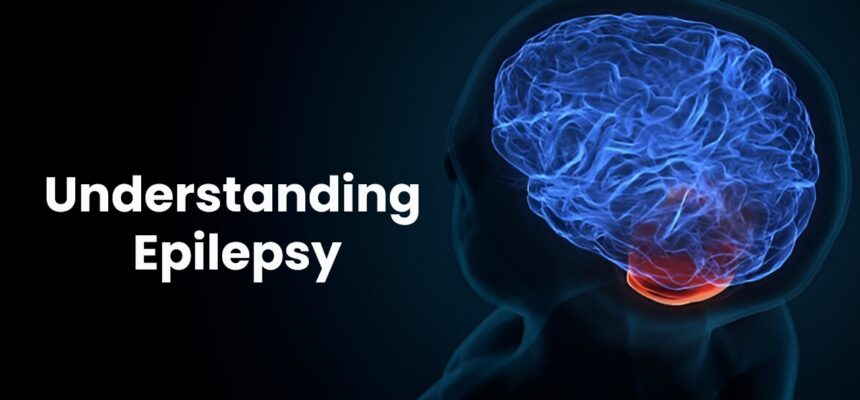 Understanding Epilepsy: A Simple Overview to a Seizure Disorder